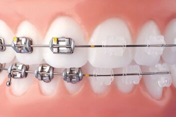 ortodontia-na-zona-leste-01 ortodontia-na-zona-leste-01