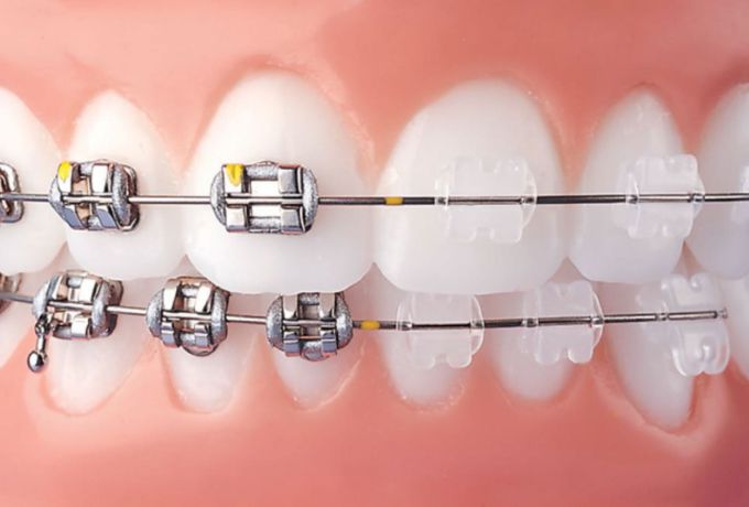 ortodontia-na-zona-leste-01