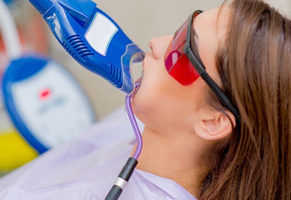 claremanto-dental-expondonto-746x413